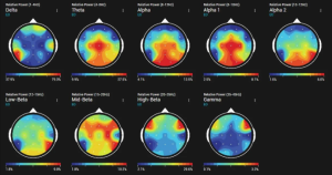 Brain Map Scans